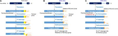 Potential Benefits of Allogeneic Haploidentical Adipose Tissue-Derived Stromal Vascular Fraction in a Hutchinson–Gilford Progeria Syndrome Patient